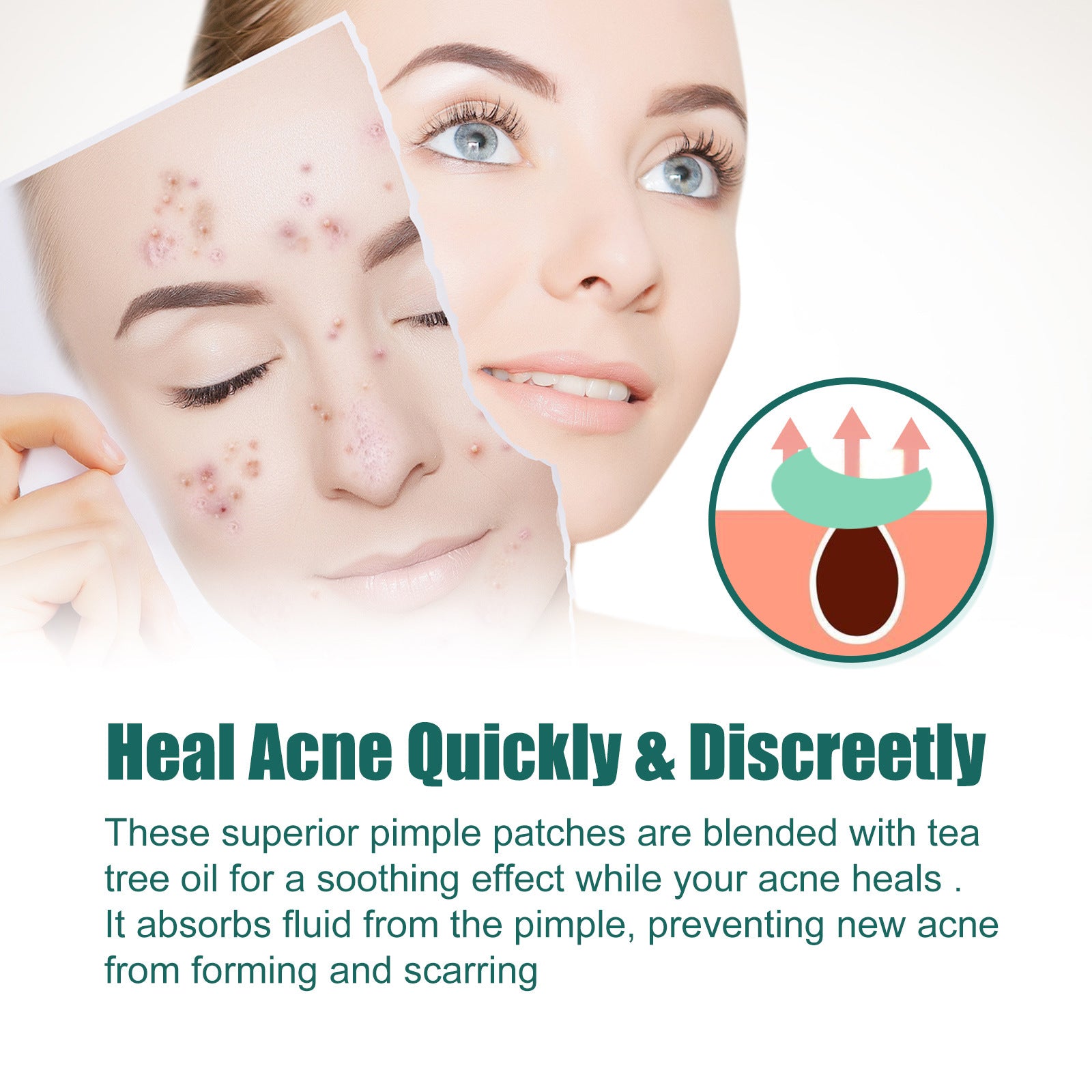EELHOE Colorful Acne Patch, Repair And Clean The Mouth Blemish Clear Pocket Colorful Shaped Acne Patch